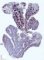 BCL2 immunostaining in adenoid