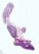 Fetal ovaries 21 weeks