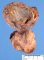 pleuropulmonary blastoma type 1
