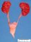 Persistent renal lobulation at 8 months in trisomy 21