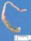 Blind colon associated with anorectal agenesis