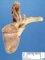 Fetal heart (20 weeks)