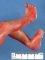 Ankle hyperflexion in oligohydramnios