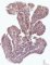 Adenoids - CD3 immunochemistry