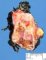 Adrenal neuroblastoma (post-chemotherapy appearance)