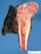 Femoral Ewing sarcoma