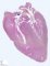 Fetal heart 18 weeks