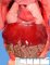 Medial liver in heterotaxy (Pulmonary right isomerism and visceral situs (...)