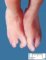 Ectrodactyly with cardiac malformation (case 12772)