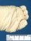 Foot oligodactyly