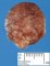 Rectal juvenile polyp