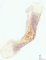 Long bone bowing