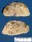 Aldosterone-secreting adrenocortical tumor (after formalin fixation)