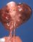 Cervical teratoma (21 weeks)