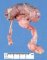 Pyeloureteral duplication (renal duplication)