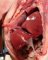 Bilateral diaphragmatic hernia in malformative syndrome