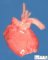 Aortic arch hypoplasia