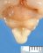 Fetal brain 12 weeks