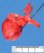 Pre-ductal aortic coarctation