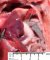 Left diaphragmatic hernia in a probable Fryns syndrome (24 weeks)