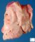 Pleural empyema