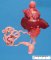 Anorectal atresia: imperforate anus and rectovesical fistula (22 (...)