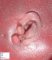 Ear anomaly