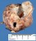Retropancreatic cystic lymphangioma