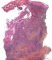 Cutaneous leishmaniasis