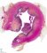 Crohn colitis