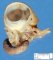 Ileocaecal digestive duplication cyst