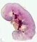 Fetal kidney 27 weeks