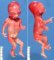Acrorenal-mandibular syndrome