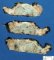 Femoral osteosarcoma (Case 12617)
