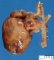 Aortic arch hypoplasia with left ventricle hypoplasia (Fetus, 24 (...)