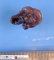 Apple peel jejunal atresia