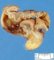 Meckel diverticula with ileal perforation