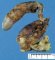 Congenital choledochal cyst