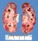 Chronic interstitial nephritis