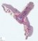 Fetal ovaries at 20 weeks