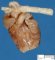 Fetal heart (20 weeks)