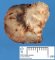pulmonary osteosarcoma metastasis