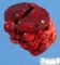 Polysplenia in malformative association