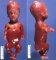 Thanatophoric dysplasia
