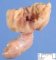 Meckel diverticula