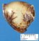 Intestinal duplication cyst