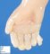 Post-axial polydactyly