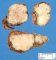 Thyroid papillary carcinoma