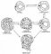 C-cell hyperplasia (AFIP, 1990)