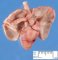 Thoracic situs inversus